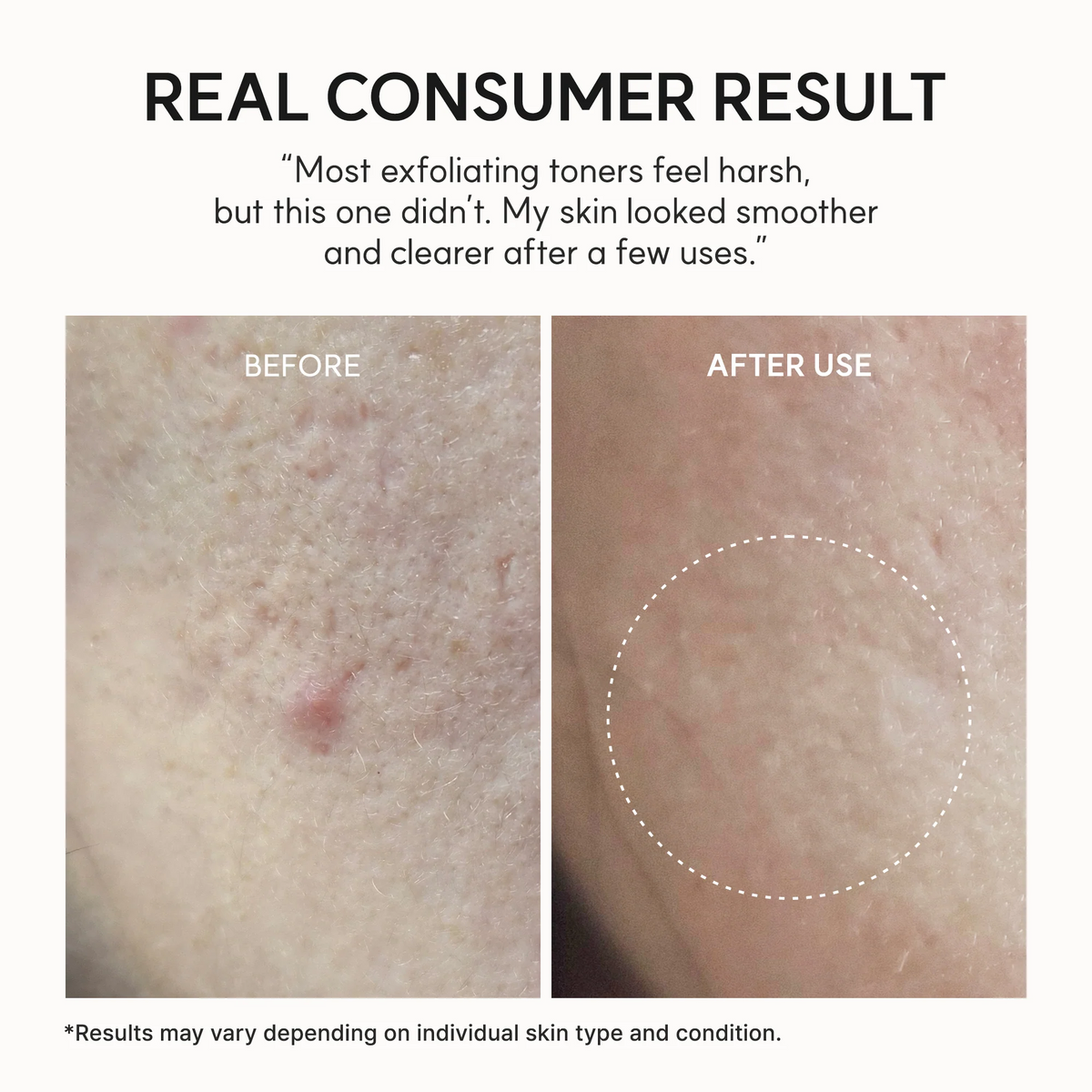 Arencia - Eraser Shot Glycolic Acid Exfoliator 200ml