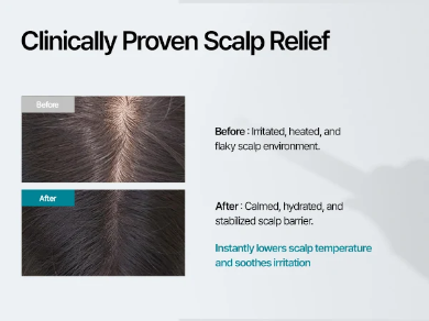 GROWUS Recover Therapy Hair Booster Serum (15ml / 0.51 fl.oz.)