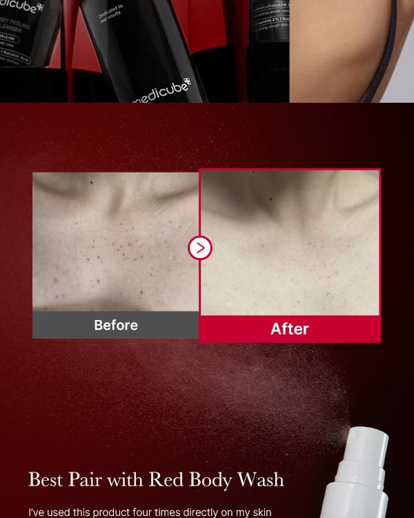 Medicube Red Acne Body Peeling Shot