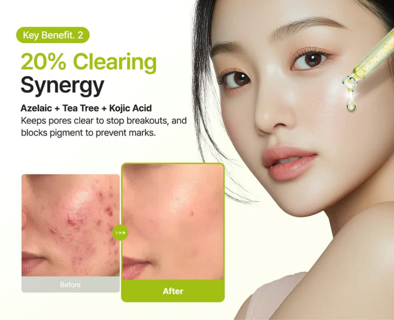 Purito SEOUL Azelaic Acid 10 Kojic Tea Tree Serum