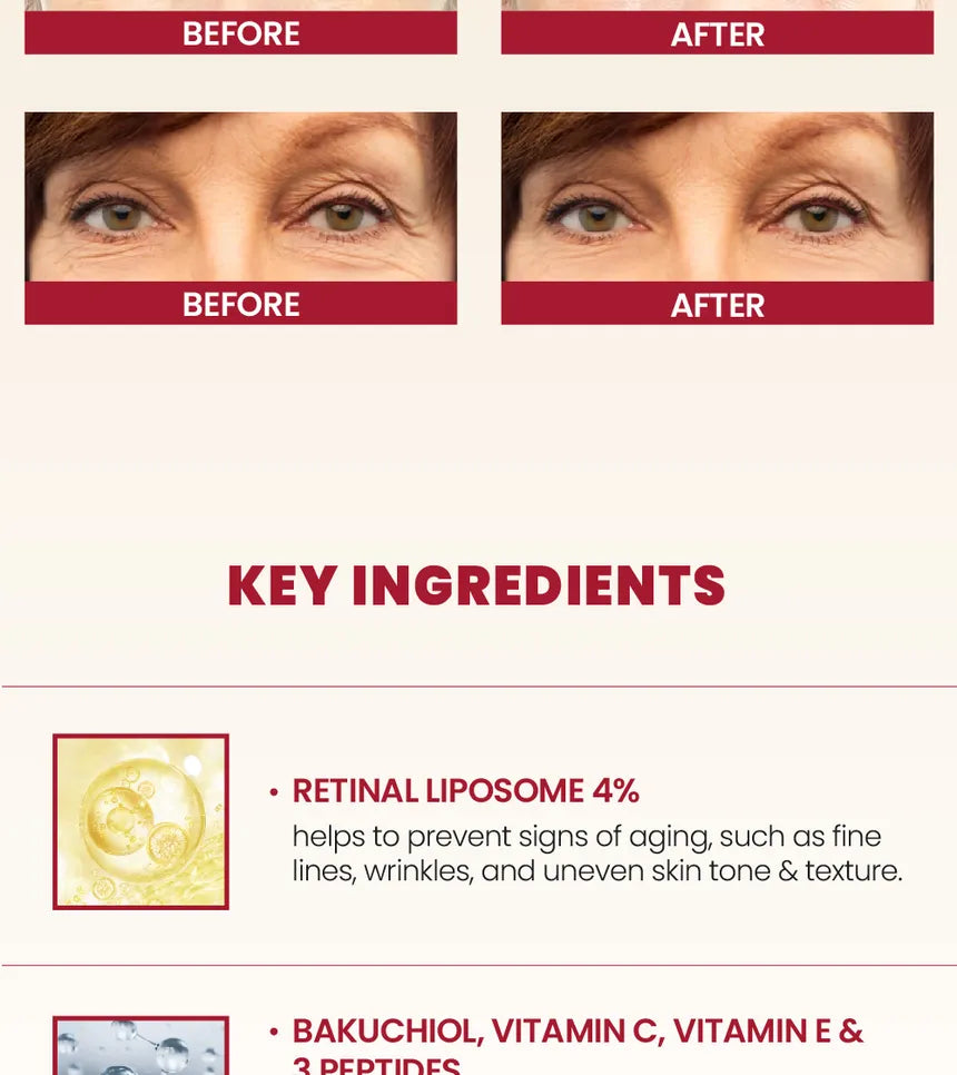 K Secret SEOUL 1988 Eye Cream Retinal Liposome 4 Fermented Bean