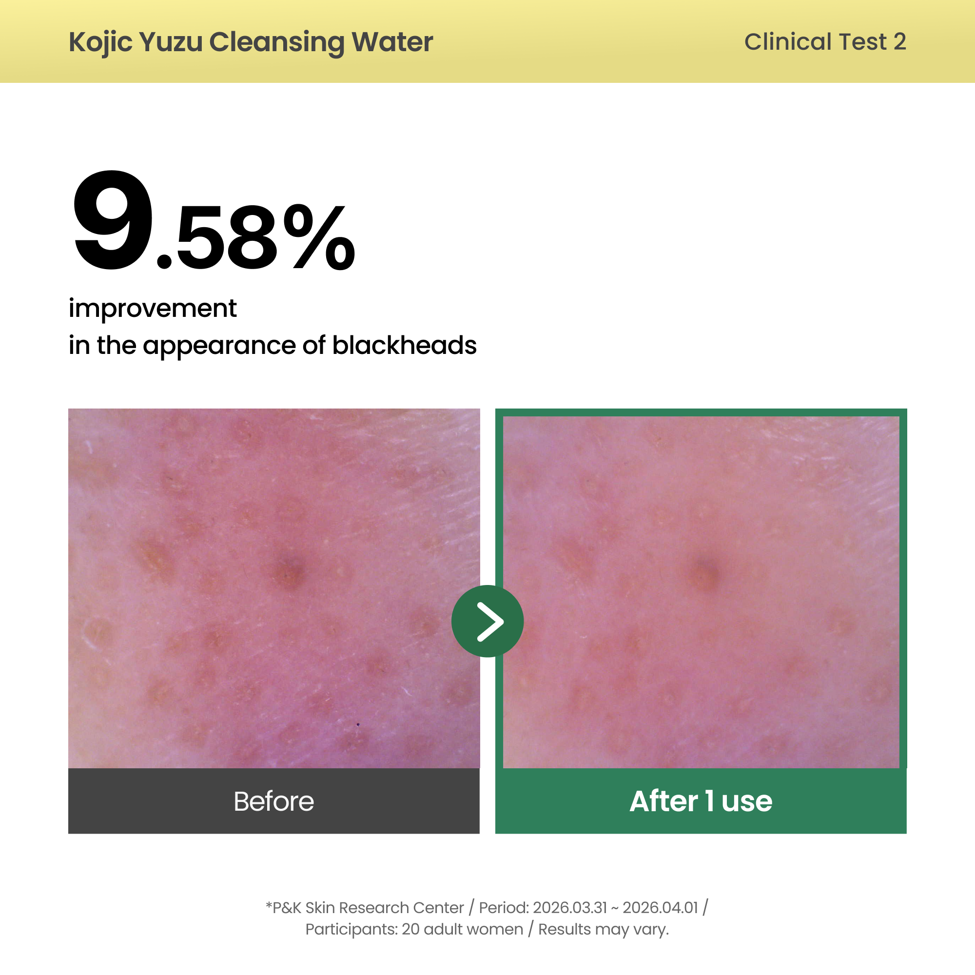 AXIS-Y - Kojic Yuzu Cleansing Water