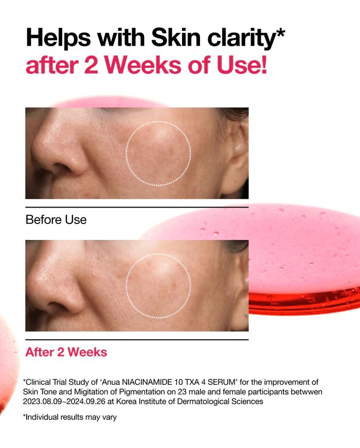 Anua NIACINAMIDE 10TXA 4 Serum