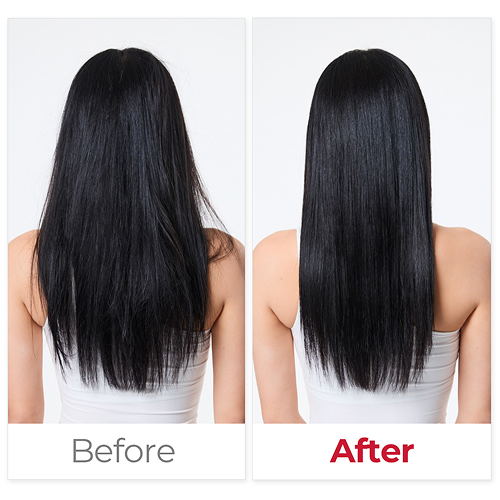 MOEV Annurcatin Hair Oil Essence