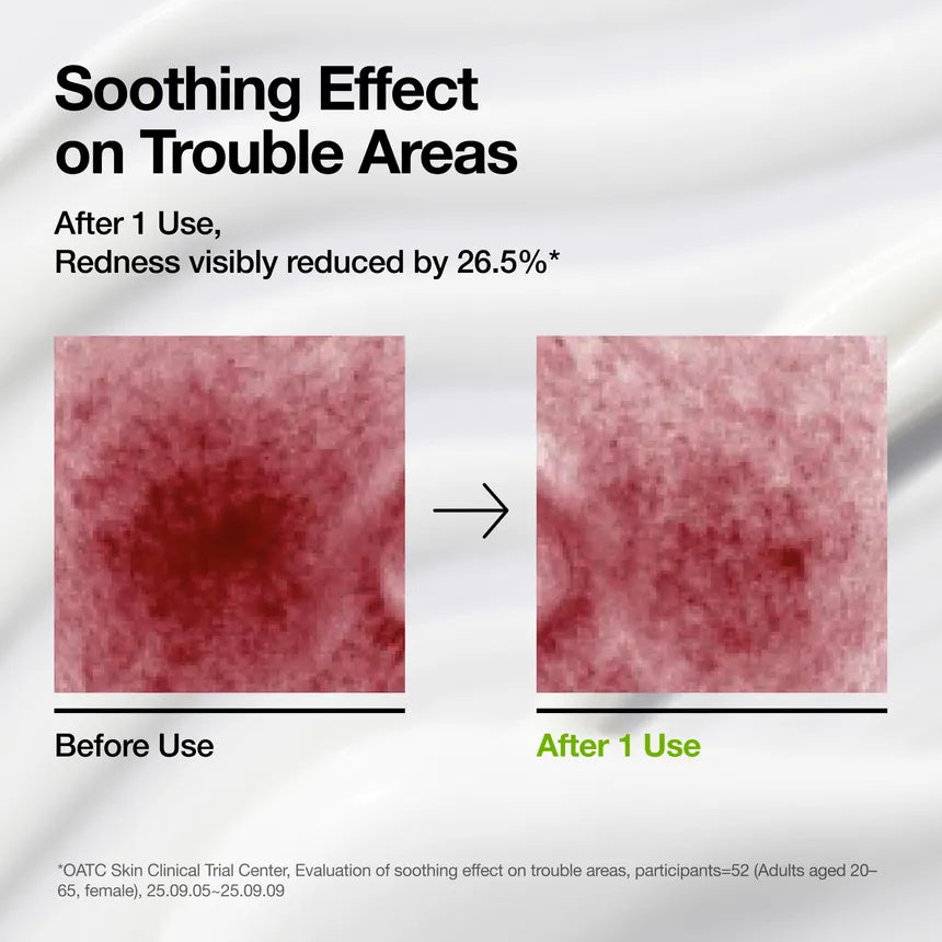 Anua - Azelaic Acid Cica Skin Soothing Moisturizer