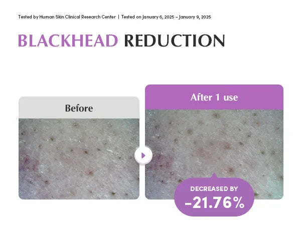 Eqqualberry Purple Rice Pore Smoothing Cleansing Oil