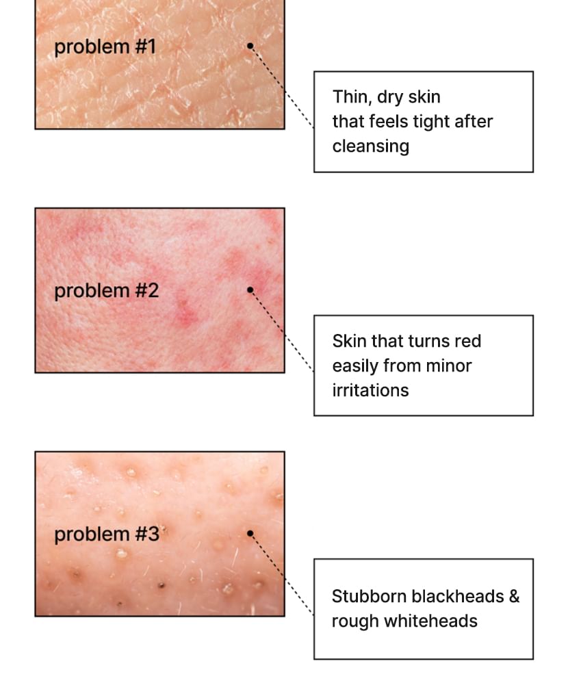 Celimax Dual Barrier Purifying Cleansing Balm