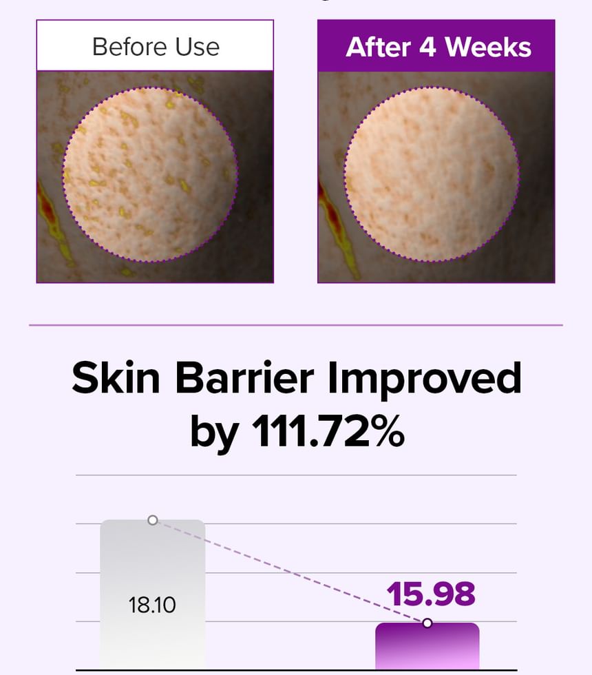 Marymay Spicule Collagen PDRN Cream